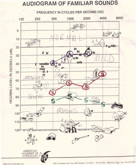 Audiogram